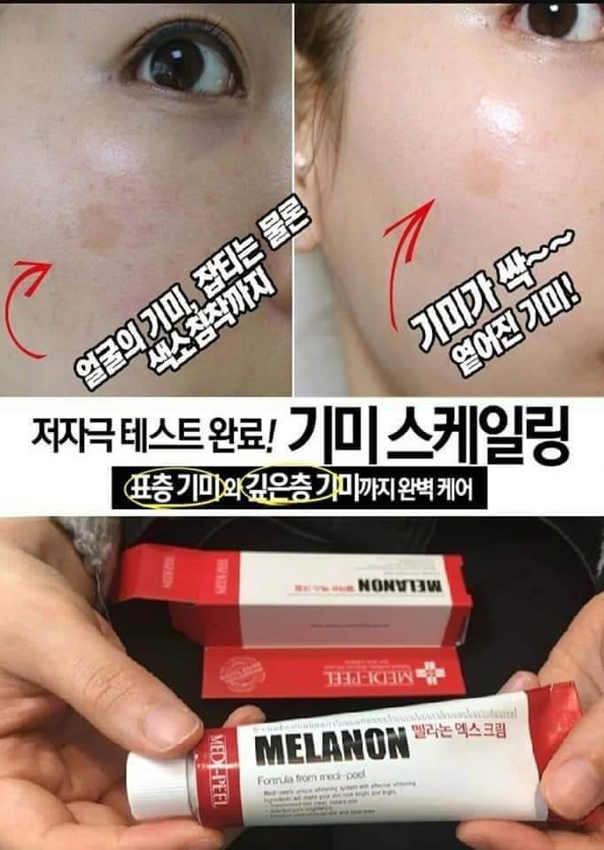 จบปัญหาฝ้า กระ Medi-Peel Melanon x Cream 30 ml. เวชสำอางค์จากเกาหลี ประกอบไปด้วยส่วนผสมของ Tranexamic Acid ( ทราเนซามิค เอซิด) ช่วยเพิ่มความกระจ่างใสให้ผิวอย่างมีประสิทธิภาพ โดยเฉพาะฝ้า รอยดำ หรือความหมองคล้ำที่เกิดจากแสงแดด   ขั้นตอนการทำงาน 1.ควบคุมเม็ดสีผิวให้อยู่ในระดับสมดุล ไม่มากเกินไป 2.ควบคุมเซลล์ผิวที่อักเสบไม่ให้แพร่กระจายและผลิตเม็ดสีเพิ่ม ให้ผิวดูสว่างใสขึ้น จุดด่างดำดูจางลง และผิวแลดูสุขภาพดี